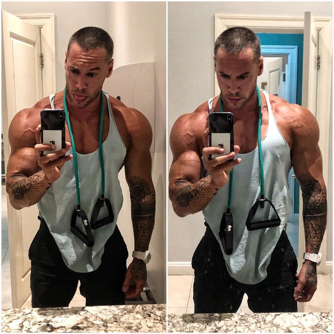 Стволовые клетки помогли чемпиону IFBB Pro из Беларуси вернуться в зал - Бодибилдинг форум AnabolicShops