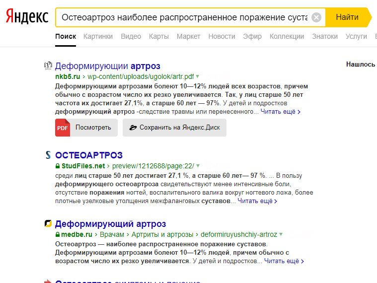 Осторожно Артроз! Введение. - Бодибилдинг форум AnabolicShops
