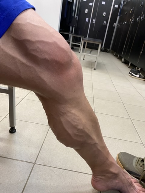 Метан VS Турик - Бодибилдинг форум AnabolicShops