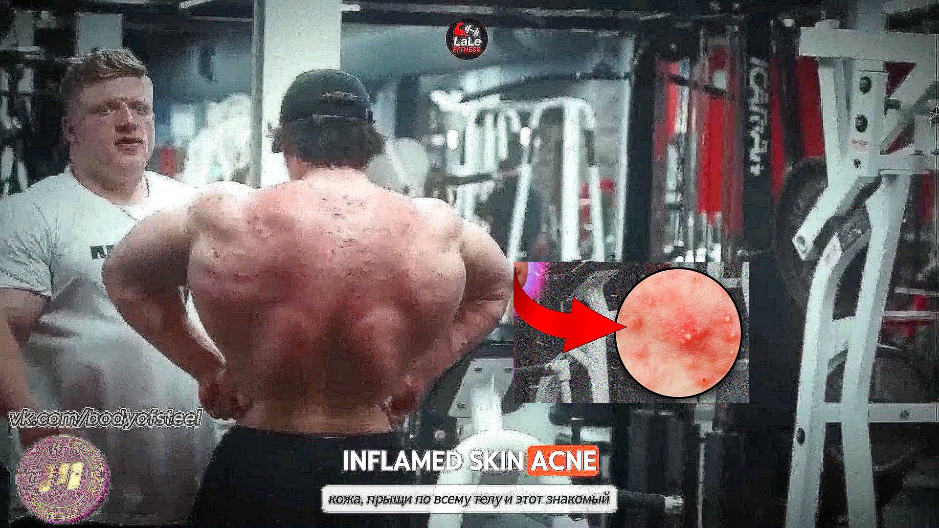Жесть от стероидов после карты IFBB Pro: Сэм Сулек в беде? - Бодибилдинг форум AnabolicShops
