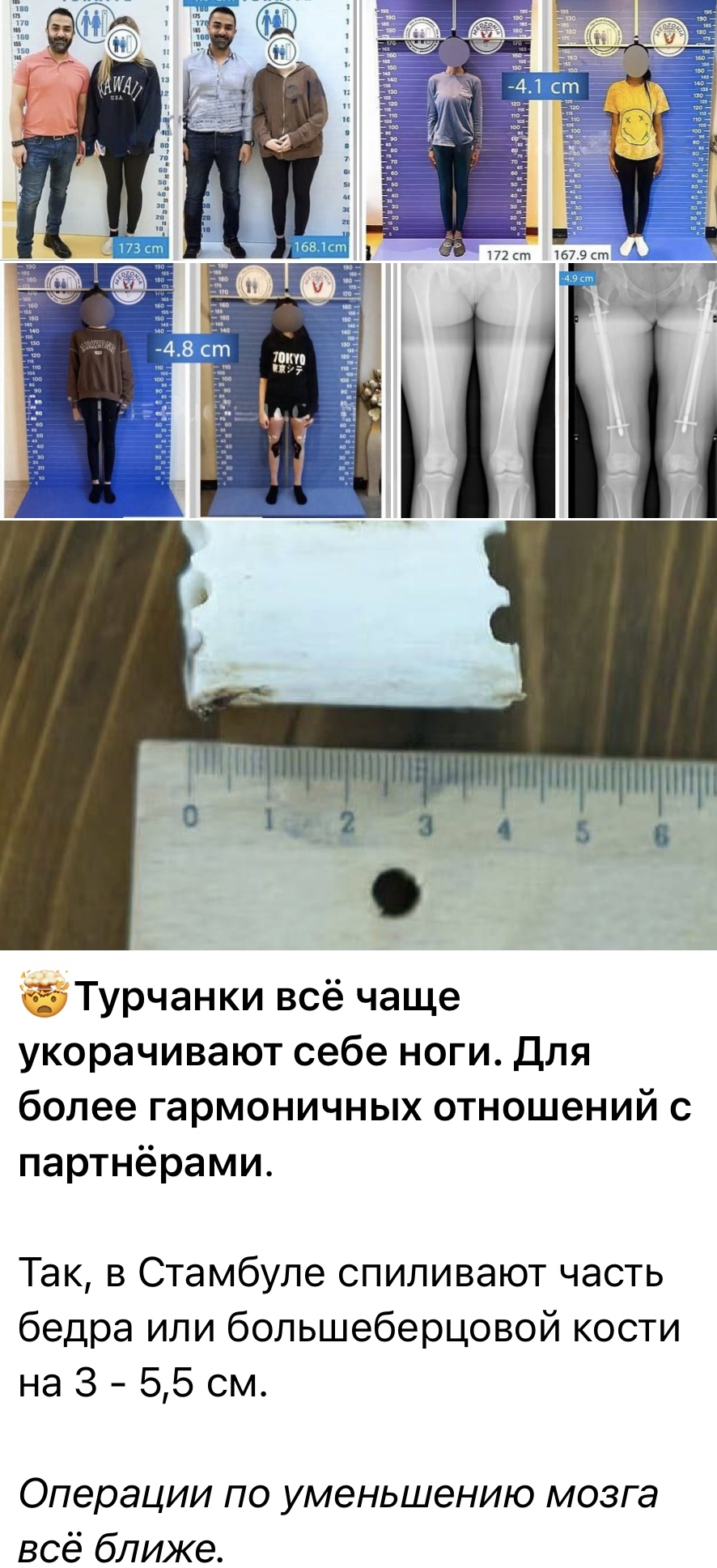 ProjectX - твой надежный поставщик! - Бодибилдинг форум AnabolicShops