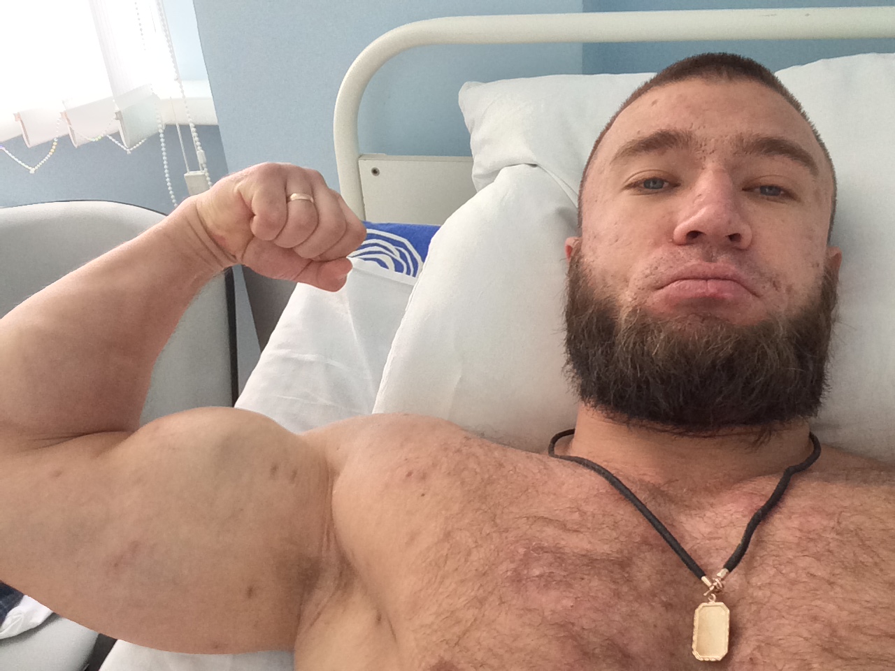 Как "СanadaPeptides" ногу залечила=] - Бодибилдинг форум AnabolicShops