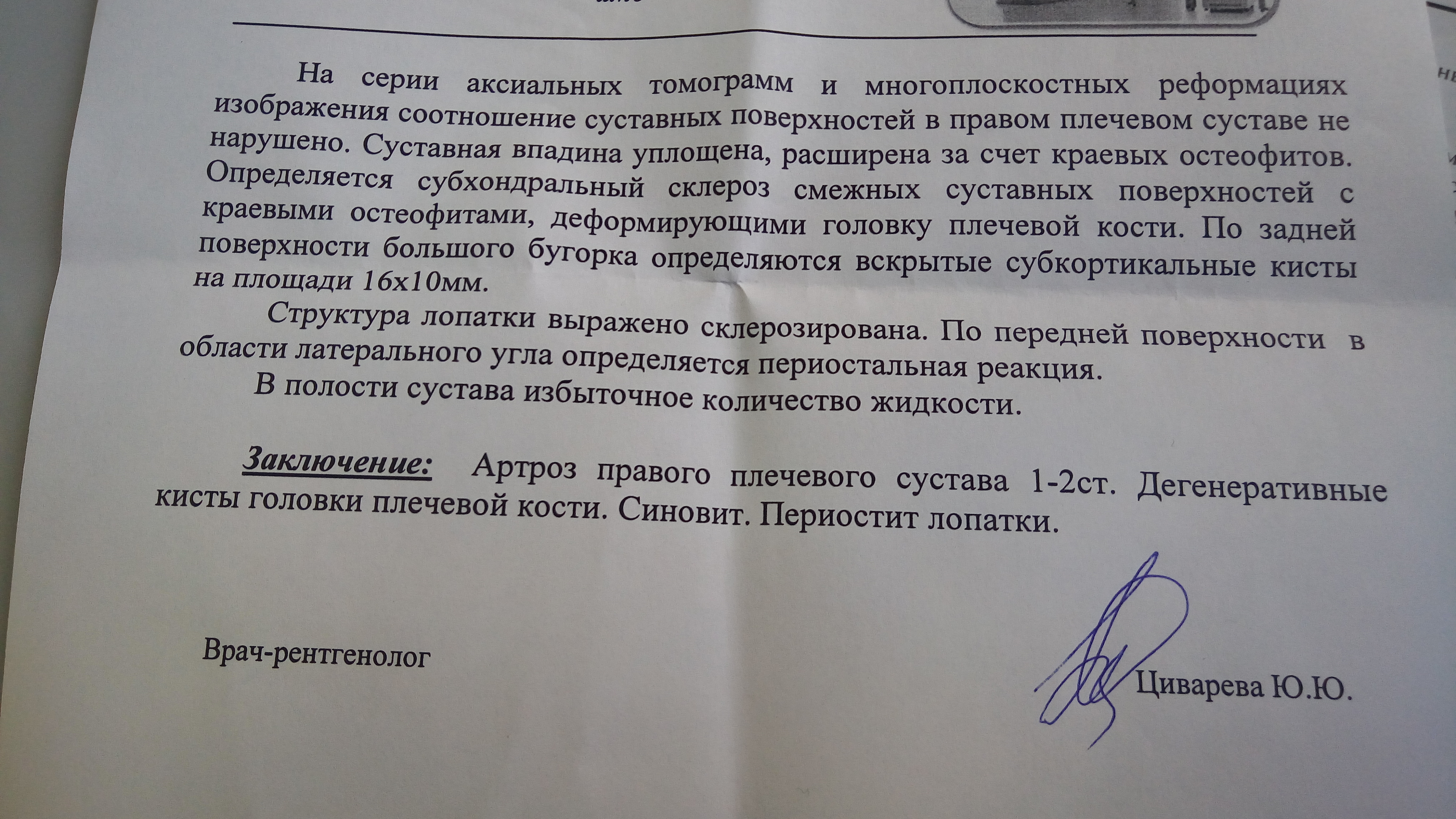 Травма Плеча - Бодибилдинг форум AnabolicShops