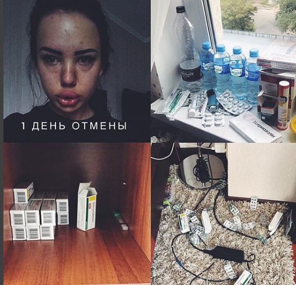 КАК И ПОЧЕМУ Я ЧУТЬ НЕ ОТКИНУЛА КОНЬКИ ‼️ - Бодибилдинг форум AnabolicShops