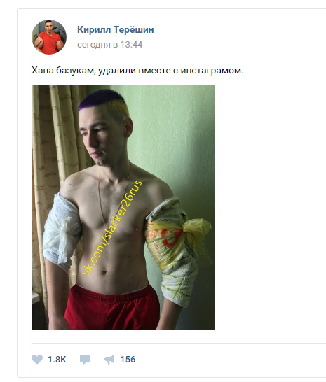 Человек-синтол остался без «рук-базук». - Бодибилдинг форум AnabolicShops
