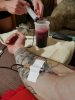 Густая кровь на курсе. Высокий гематокрит. Слив крови - Бодибилдинг форум AnabolicShops