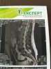 Тренировки с межпозвоночной грыжей. - Бодибилдинг форум AnabolicShops